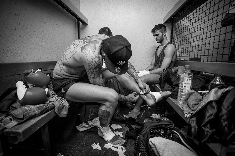 Basti removes bandages after his fight.